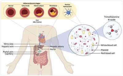 Emerging computational paradigms to address the complex role of gut microbial metabolism in cardiovascular diseases